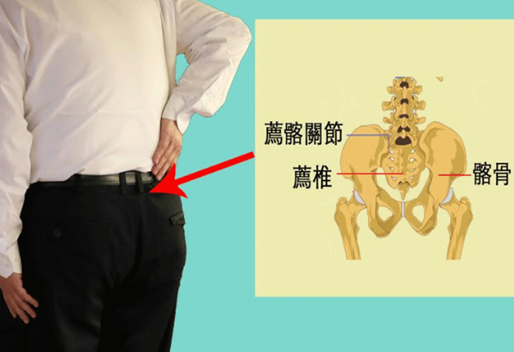 荐髂关节又称作「荐肠关节」,位在荐椎(尾椎骨)与肠骨(骨盆)的交界处.