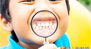 小孩患牙周病　免疫失調病程快速