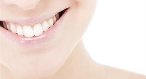 牙齒美白的魔法　打造少女時代的微笑