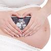 產婦死亡風險排名　胎兒過大造成大出血