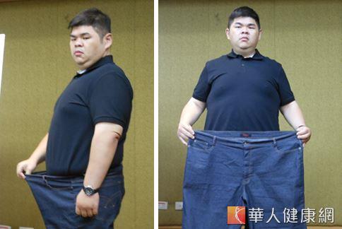 本身是厨师的黄志伟，因有家族肥胖史和高脂饮食等习惯，造成病态性肥胖，但经16个月的内科治疗，目前腰围已大幅缩小。（摄影／骆慧雯）