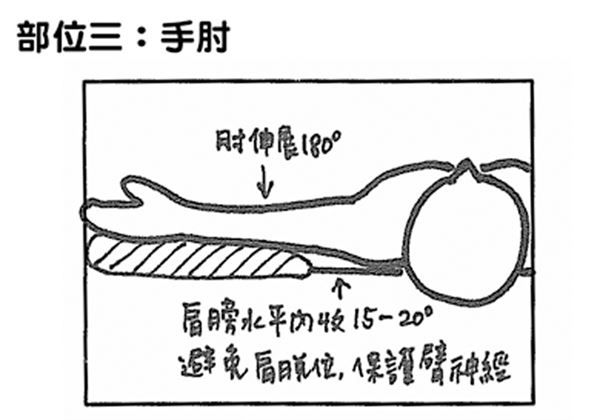 手肘部位的摆位复健,目的在于透过适度的支撑来保持手臂的延展性