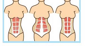 產後運動消肚關鍵：腹直肌分離程度