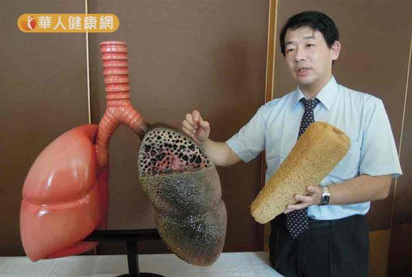 肺纤维化真实图片