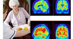 美國研究：老年人熱量攝取太多小心失憶
