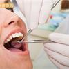 洗牙不只加強清潔　更能幫助去除「菌膜」