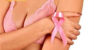 關節腫脹變形　乳癌淋巴水腫新手術改善