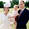 凱特王妃產後厭食症　營養師：瘦過頭危險