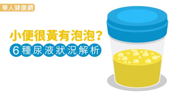 小便很黃有泡泡 6種尿液狀況解析 華人健康網