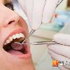 治療二次蛀牙　3D齒雕免磨牙