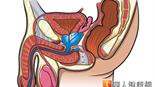 扁攝護腺癌？醫師：需測PSA與肛門指檢
