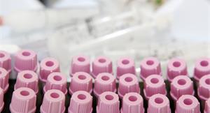 國家實驗室公開　能檢出7個乙型受體素