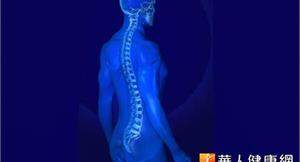僵直性脊椎炎伴隨壓迫性骨折　才需打骨泥