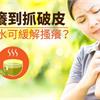 濕疹癢到抓破皮　泡茶葉水可緩解搔癢？