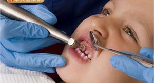 乳牙健康很重要！傷牙5危險因子快戒掉