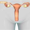 經期提早來，是卵巢早衰現象？