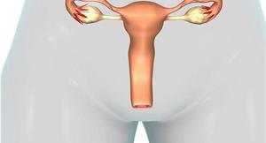 經期提早來，是卵巢早衰現象？