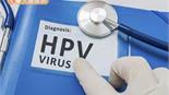 沖洗陰道就能避免感染HPV？近6成年輕人認知不清