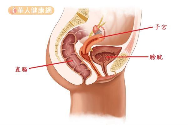 小禎經痛只能泡浴缸嬌問 子宮後傾跟經痛有關嗎 華人健康網