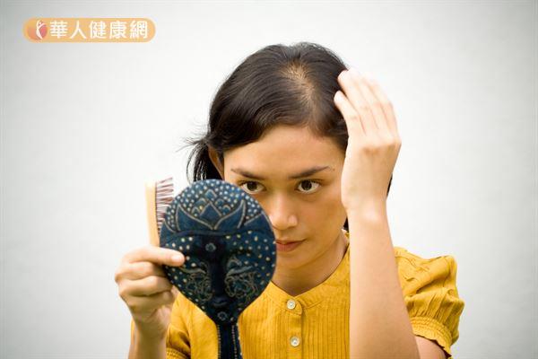 随着女性荷尔蒙减少,更年期的女人也有可能出现雄性秃的现象。
