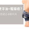 大便浮油=罹腸癌？其實隱藏這4種疾病