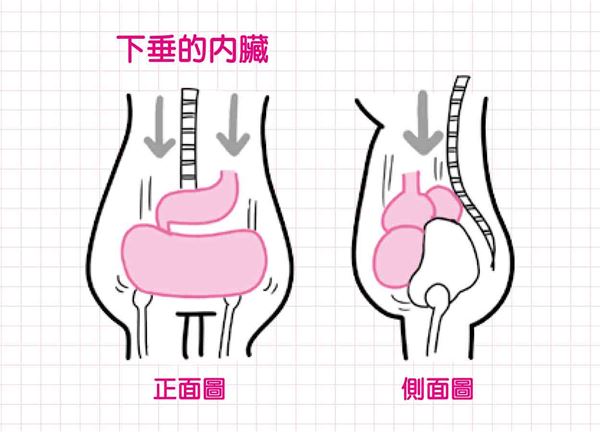 不想小腹凸出,做对3件事防「内脏下垂」 