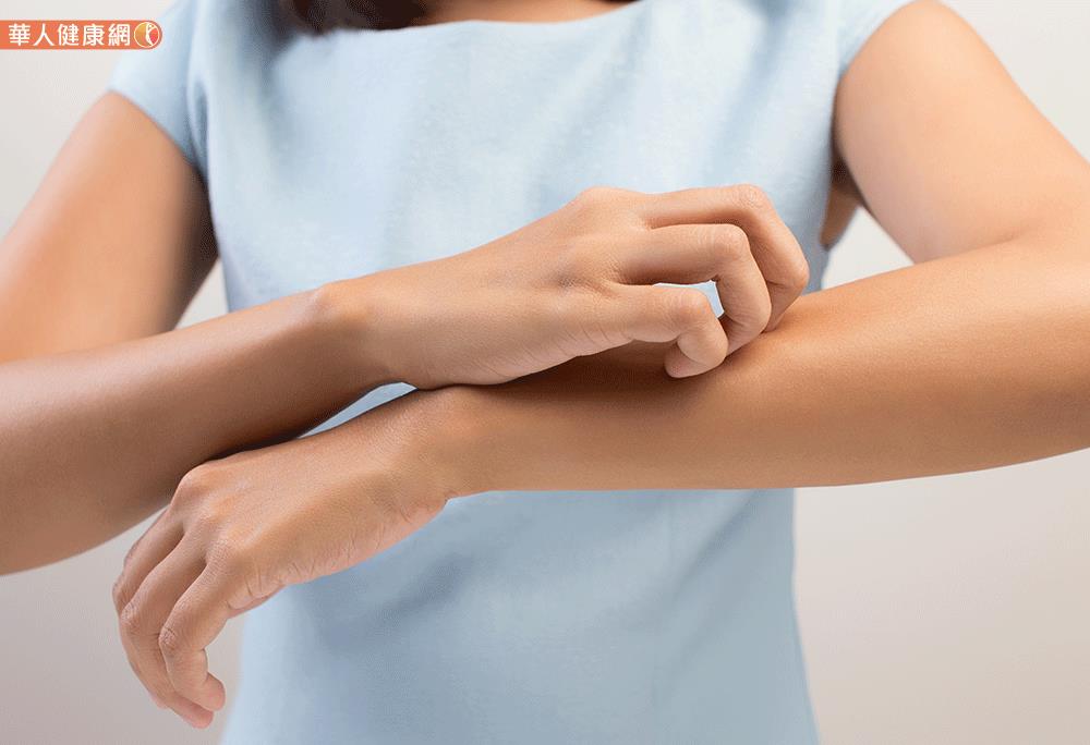 在臨床只要是無法被明確診斷的皮膚發炎症狀，多被歸為「濕疹」。