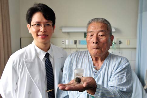 李政鴻醫師（左）表示，老翁因3公分膽結石撐破小腸，造成小腸多處潰瘍，且引起嚴重腹膜炎，才會出現急性劇痛的症狀。（圖片提供／大林慈濟醫院）