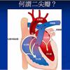 心臟變胖藏鏡人-二尖瓣逆流　修補可取代心臟移植