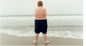 青少年過度肥胖　罹患膽結石增8倍