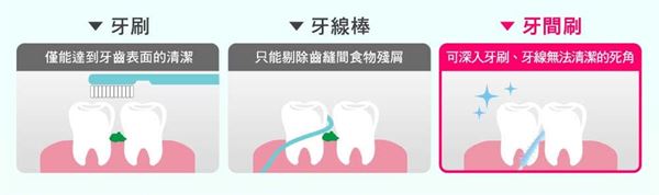 除正確的刷牙習慣與搭配牙線清潔外，醫院醫學專欄表示可以藉由牙間刷來清潔相鄰牙齒間的食物殘屑與清除相鄰兩側牙面上的牙菌斑