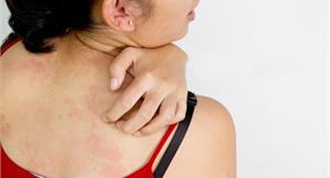 頸部腫塊突起　小心是甲狀腺結節