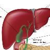 如何打斷肝—肝硬化—肝癌三部曲