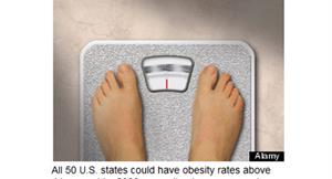 瘦不了！美2030年將有4成肥胖人口
