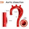 防主動脈剝離猝死！除了多囊腎、馬凡氏症患者應當心，更要小心無控制的高血壓