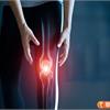 膝蓋痛、走路困難恐是退化性關節炎？退化性膝關節炎疑惑大解密