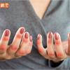 「全身性紅斑狼瘡」好發於年輕女性！醫師：5原則幫助有效控制