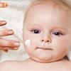 異位性皮膚炎是幼兒過敏首部曲！醫師籲：把握2歲前黃金治療期