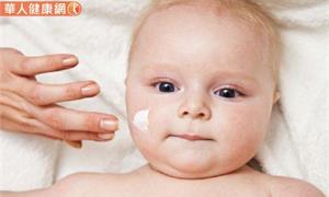 異位性皮膚炎是幼兒過敏首部曲！醫師籲：把握2歲前黃金治療期