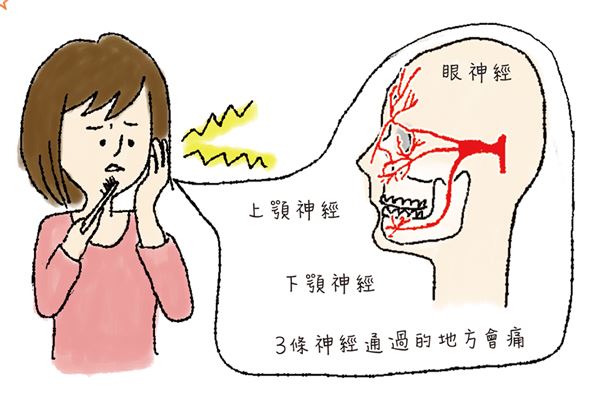 刷牙洗脸碰到脸颊就有触电感是牙痛吗日本医学博士揭三叉神经痛2症状