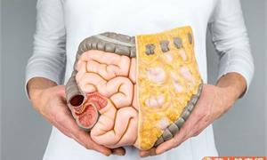 大腸鏡檢查正常就安啦？大腸瘜肉5年內變大腸癌，千萬別忽視「大腸間隔癌」