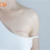 乳癌居婦女癌症發生率第一名！「3D乳房斷層攝影」診斷新利器