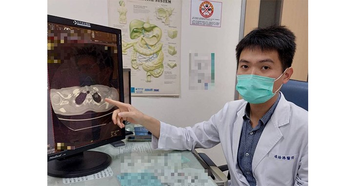 大千綜合醫院胸腔外科楊絡勝醫師表示,常見的肺癌危險因子包含:重度吸菸者、有肺癌家族史者、致癌環境、慢性肺部疾病等。(圖片提供/大千綜合醫院)