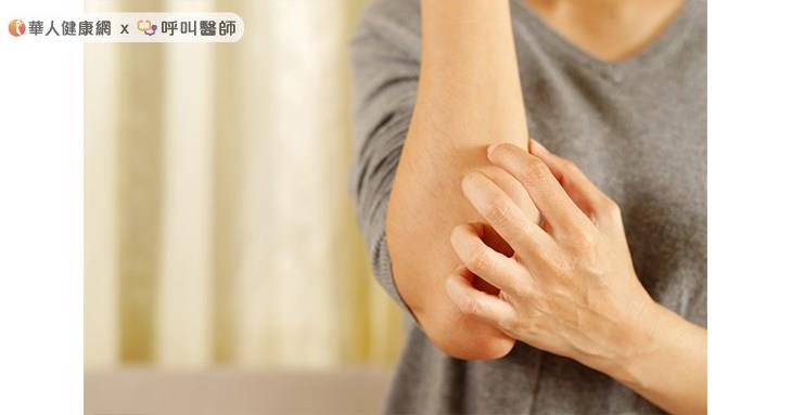 根據統計，台灣有超過200萬名異位性皮膚炎患者，很多病友從嬰幼兒時期就開始發病，除嚴重搔癢帶來的不適外，紅斑、丘疹及反覆發作造成的皮膚苔蘚化，也間接影響到患者自信、社交及人際關係發展。