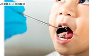 5歲童齲齒竟釀蜂窩性組織炎，一口氣拔掉9顆牙！兒少口腔保健123護牙