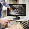 孕婦前置胎盤合併植入性胎盤，一邊出血、一邊止不住超危險！