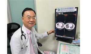 驚！婦濃稠痰液撐大細支氣管，竟像一串串葡萄！醫妙手解除呼吸困難