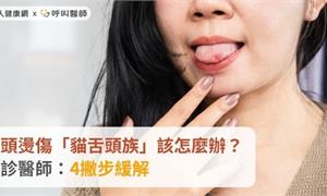 舌頭燙傷「貓舌頭族」該怎麼辦？急診醫師：4撇步緩解