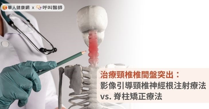 治療頸椎椎間盤突出：影像引導頸椎神經根注射療法 vs. 脊柱矯正療法