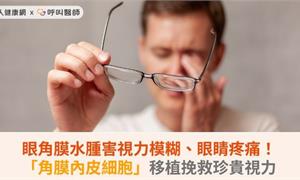 眼角膜水腫害視力模糊、眼睛疼痛！「角膜內皮細胞」移植挽救珍貴視力